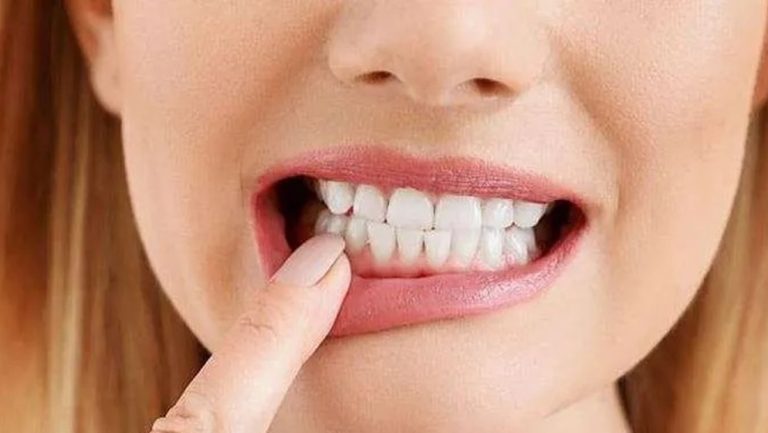 الحلم بالاسنان لابن سيرين